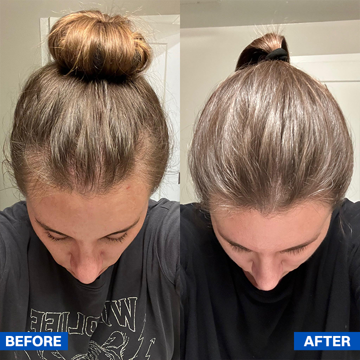 LIMETOW® Scalpy Hair Serum — The Scalp-First Hair Growth Breakthrough