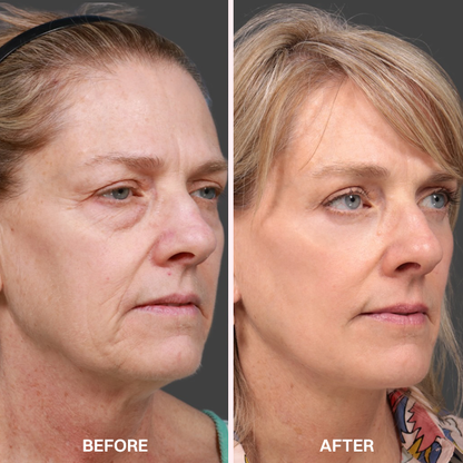 LIMETOW® Advanced Anti-Aging Serum