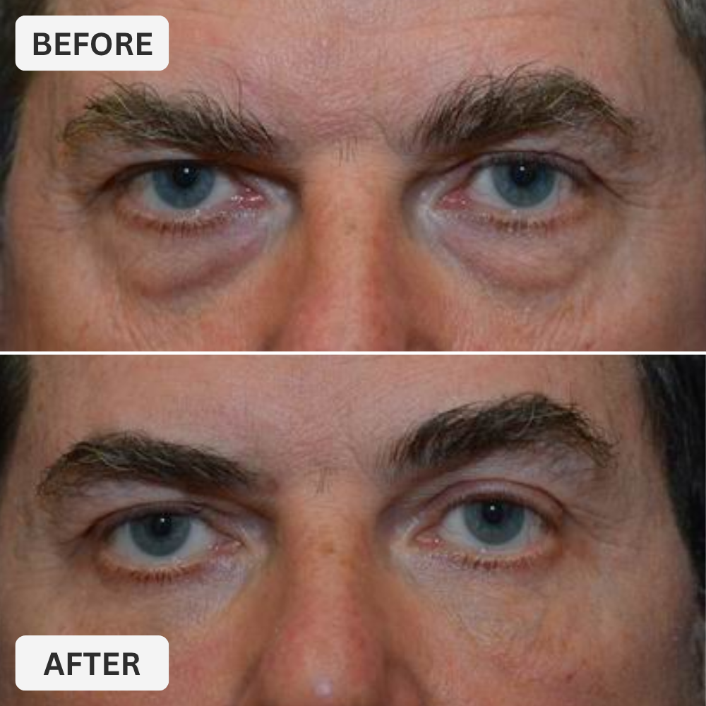 Eye Repair Stick