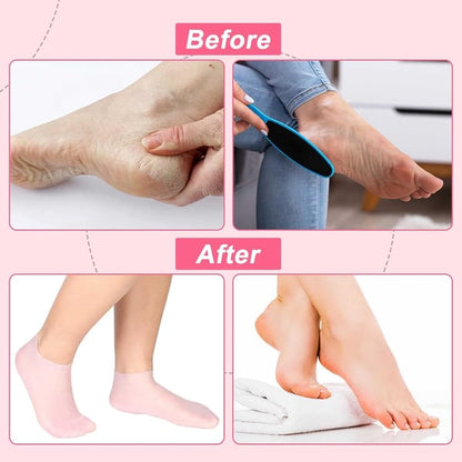 🔥Moisturizing Foot Mask Exfoliating Silicone Socks Beach Protective Socks