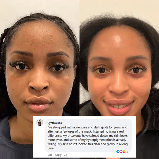LIMETOW® Collagen Night Wrapping Mask