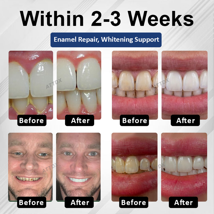 BioEnamel Biomimetic Tooth Armor Drops