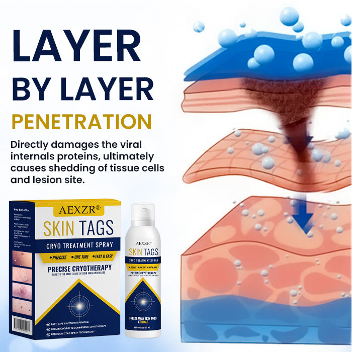 Skin Tag Cryo Treatment Spray