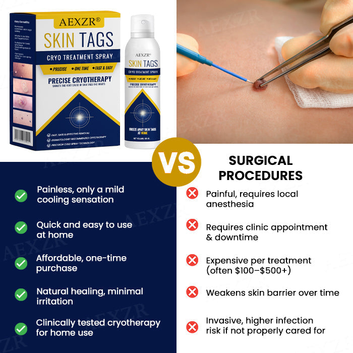 Skin Tag Cryo Treatment Spray