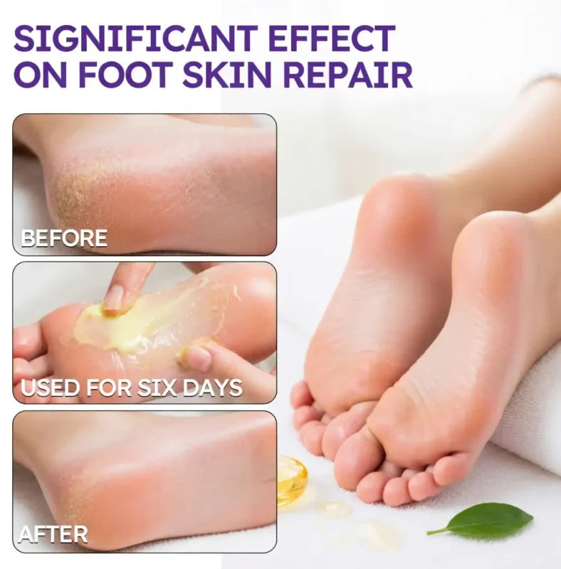 LIMETOW® Tea Tree Oil Foot Cream