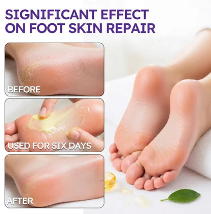 LIMETOW® Tea Tree Oil Foot Cream