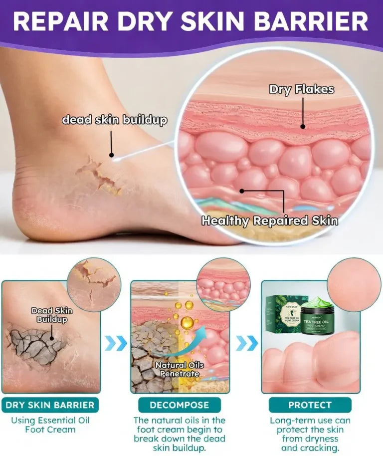 LIMETOW® Tea Tree Oil Foot Cream