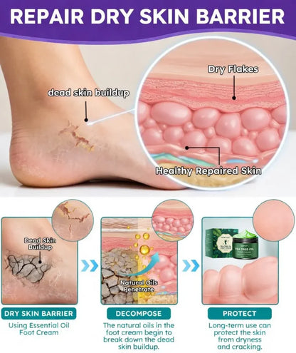 LIMETOW® Tea Tree Oil Foot Cream