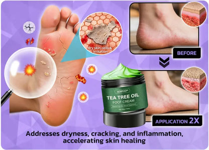 LIMETOW® Tea Tree Oil Foot Cream