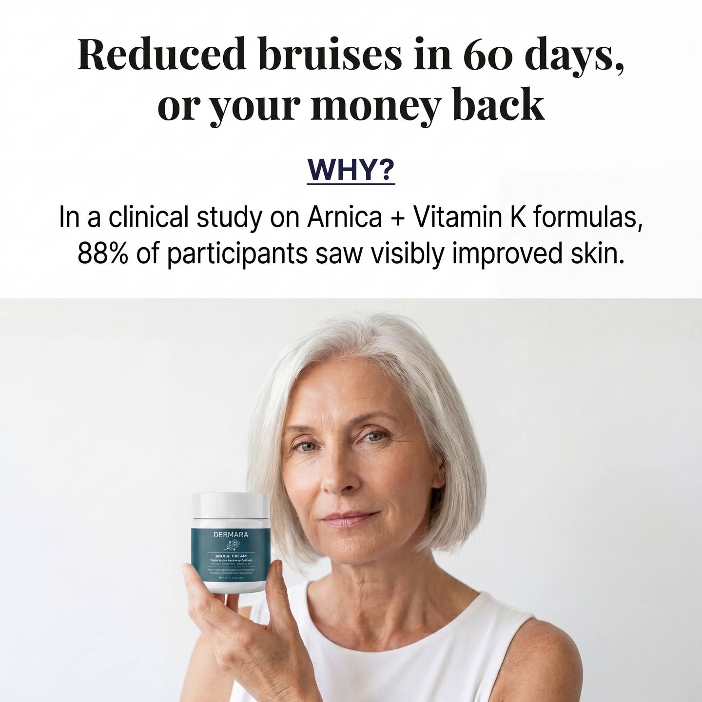 Finally, A Cream That Fades Bruises On Fragile Skin