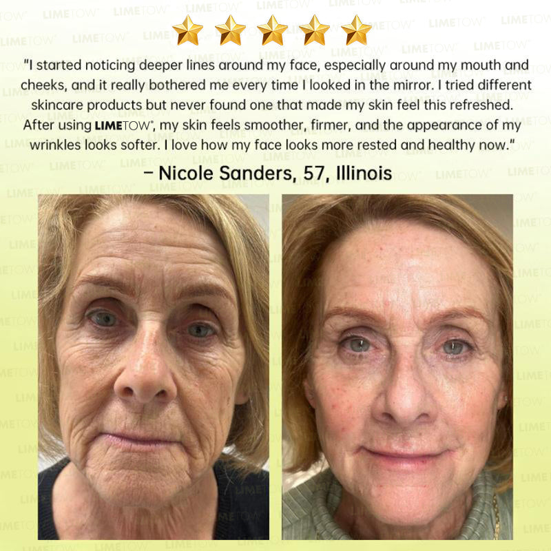 🏅💧💐LIMETOW® Multi-Peptide Retinol Shot Wrinkle-Lift Cream