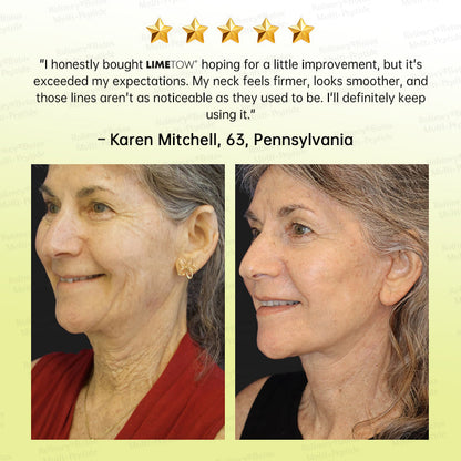 🏅💧💐LIMETOW® Multi-Peptide Retinol Shot Wrinkle-Lift Cream