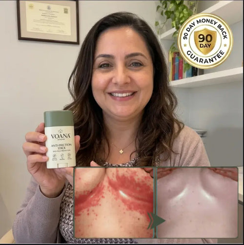 Anti-Friction Stick | Relieves Pain and Redness in 2 Minutes