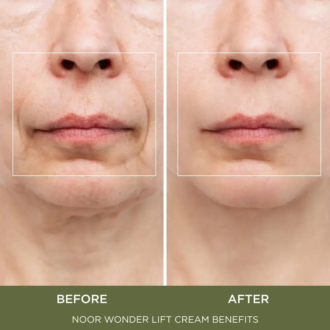Combat Wrinkles, Crow’s Feet and Fine Lines Today With Proven Ingredients