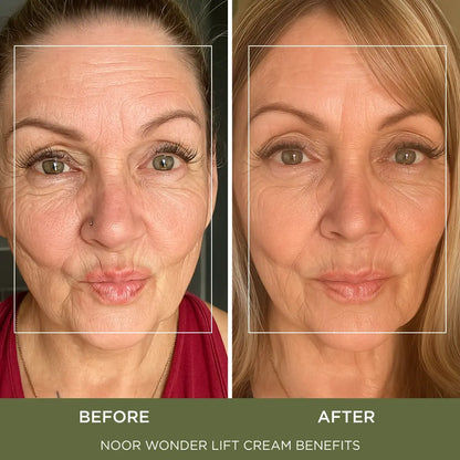 Combat Wrinkles, Crow’s Feet and Fine Lines Today With Proven Ingredients