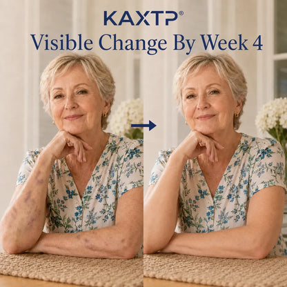 Those Purple Marks On Your Arms Aren't Your Fault, And KAXTP® Is Finally Something Gentle for Them