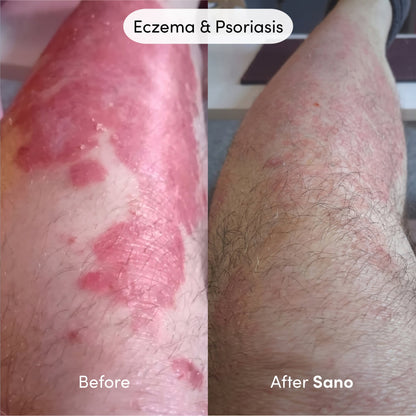 Natural Skin Repair Cream