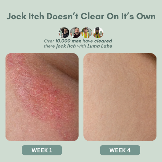 Triple Relief Cream