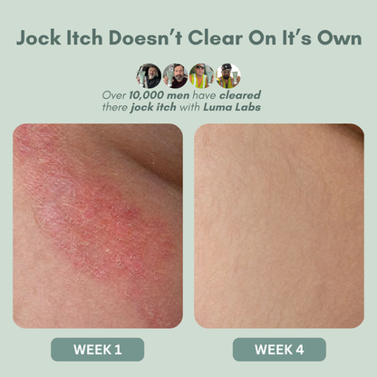 Triple Relief Cream