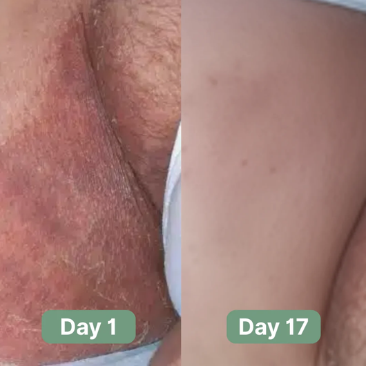 Triple Relief Cream