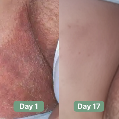 Triple Relief Cream