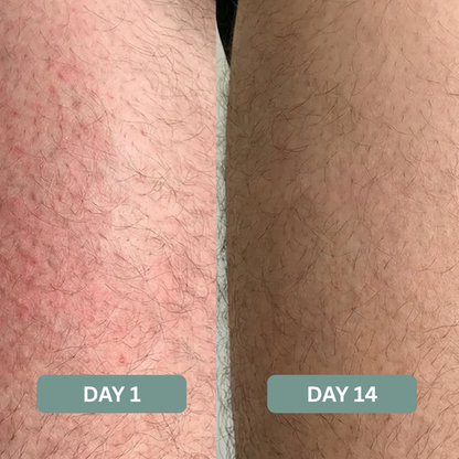 Triple Relief Cream