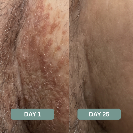 Triple Relief Cream