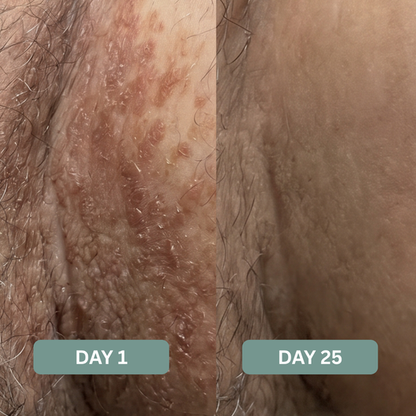 Triple Relief Cream