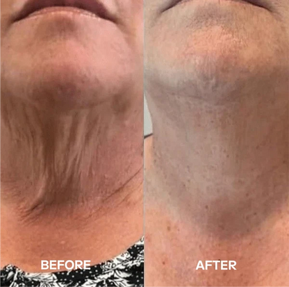 Bio-Collagen Neck Mask