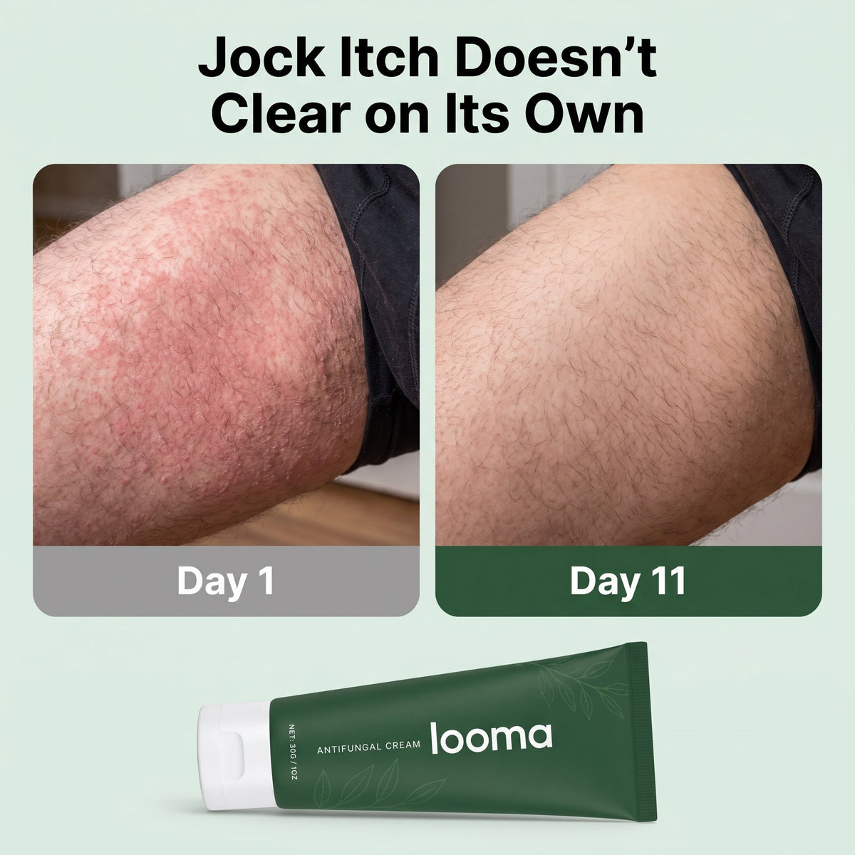 Antifungal Barrier Cream