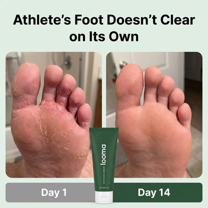 Antifungal Barrier Cream