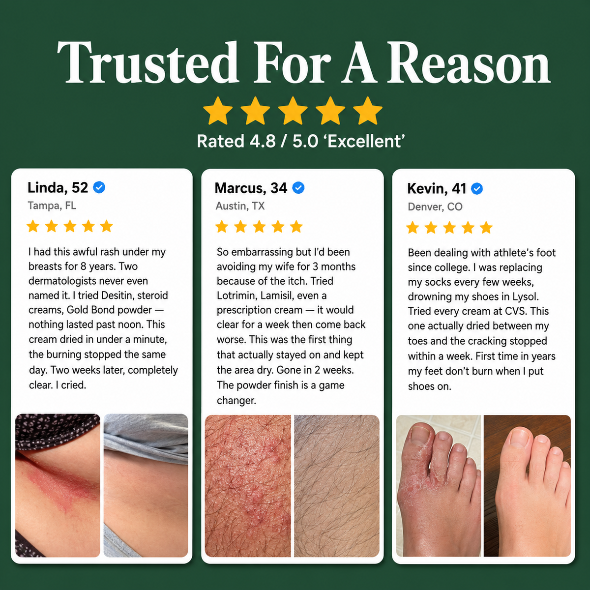 Antifungal Barrier Cream