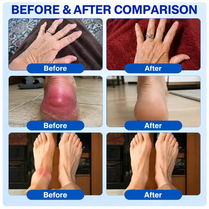 ArthriCare Diclofenac Advanced Formula Joint Comfort & Mobility Cream