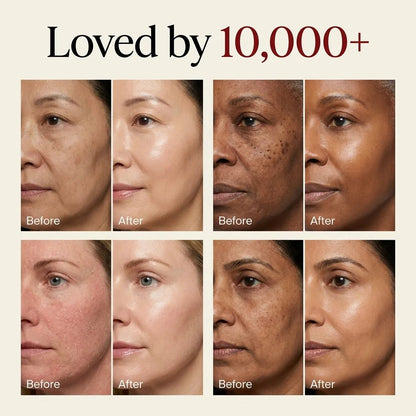 Korean Rice Face Peel
