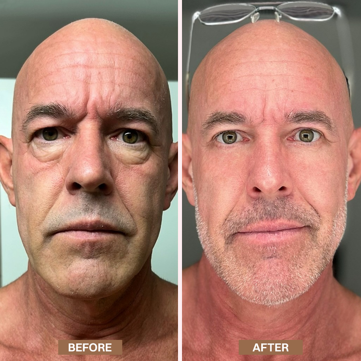 Limited-Time Offer⚡LIMETOW® Enhanse Under Eye Gel