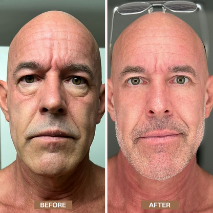 Limited-Time Offer⚡LIMETOW® Enhanse Under Eye Gel