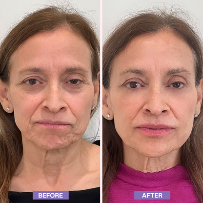 LIMETOW® Instant Lift Eye Gel