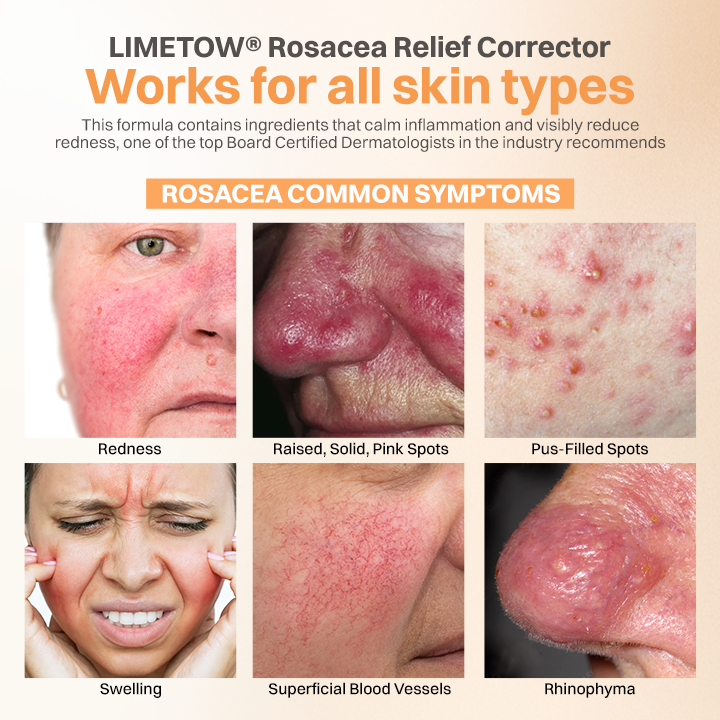 LIMETOW® Rosacea Relief Corrector