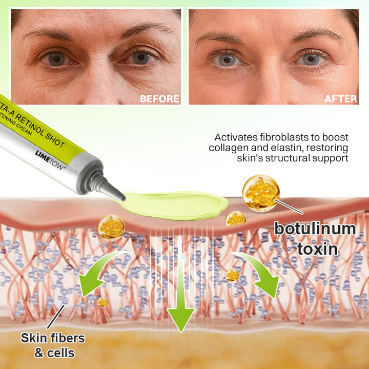 LIMETOW® Botox & Vita-A Retinol Shot Wrinkle-Lift Tightening Cream