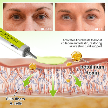 LIMETOW® Botox & Vita-A Retinol Shot Wrinkle-Lift Tightening Cream