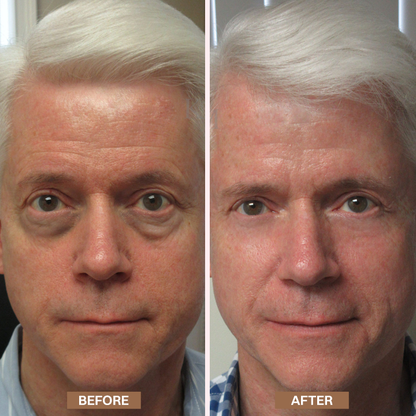Limited-Time Offer⚡LIMETOW® Enhanse Under Eye Gel