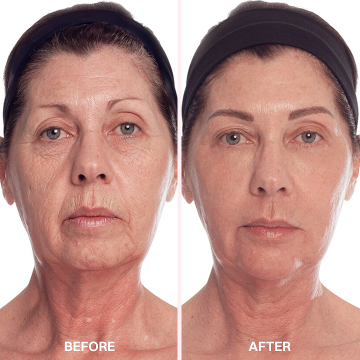 LIMETOW® Advanced Anti-Aging Serum
