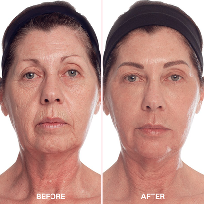 LIMETOW® Advanced Anti-Aging Serum