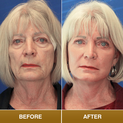 LIMETOW® Polypeptide Collagen Elastic Essence Cream