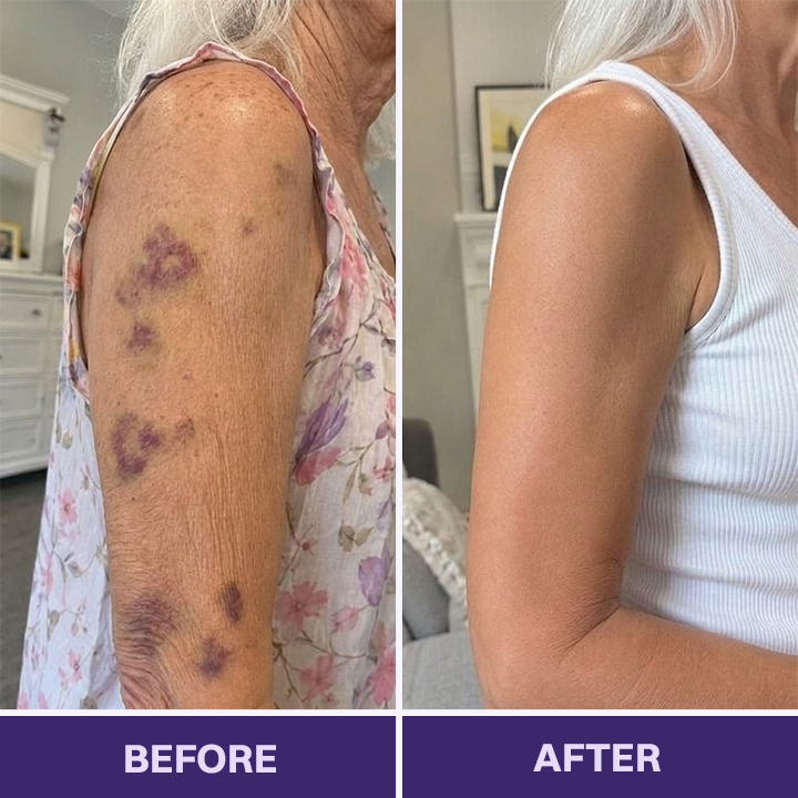 LIMETOW® Bruise Repair & Skin-Strengthening Cream