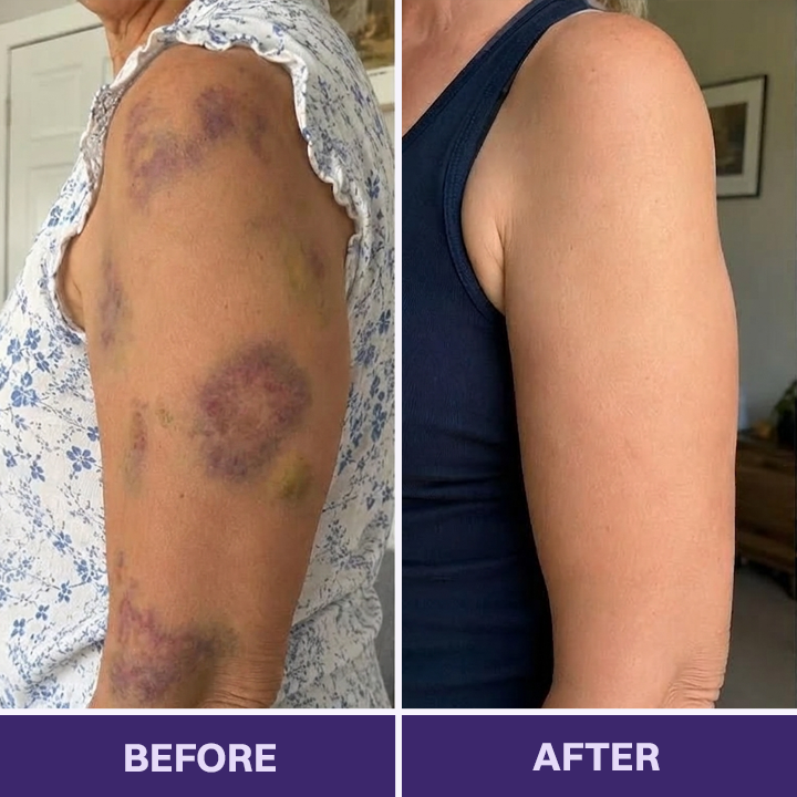 LIMETOW® Bruise Repair & Skin-Strengthening Cream