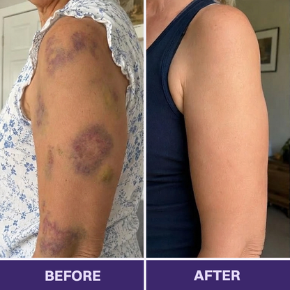 LIMETOW® Bruise Repair & Skin-Strengthening Cream