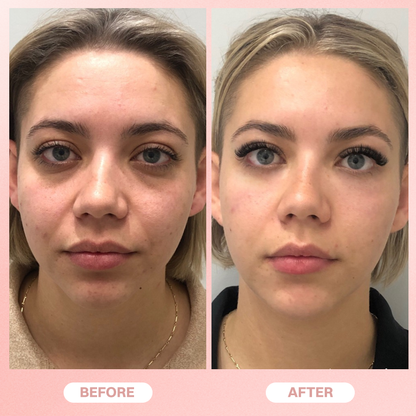 LIMETOW® Under Eye Brightener