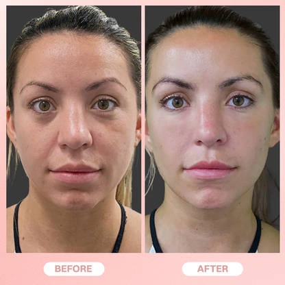 LIMETOW® Under Eye Brightener