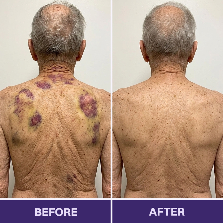 LIMETOW® Bruise Repair & Skin-Strengthening Cream